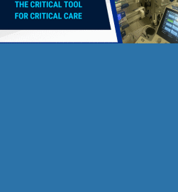 Neurosonology – The Critical Tool for Critical Care